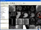 PaxeraMed DICOM Viewer